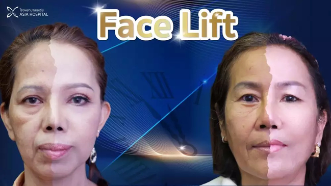 Slider image (7) Asia Cosmetic Hospital